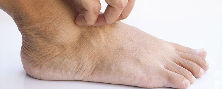 Problemas nos pés: O que podem significar?