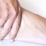 Dores na canela podem ser síndrome da tensão tibial. Você sabe o que é?