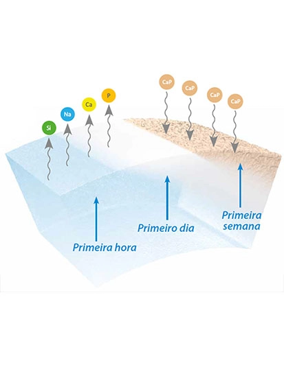 Tratamento de Infecções ósseas
