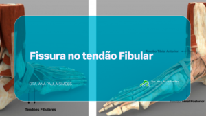 fissura no tendão fibular