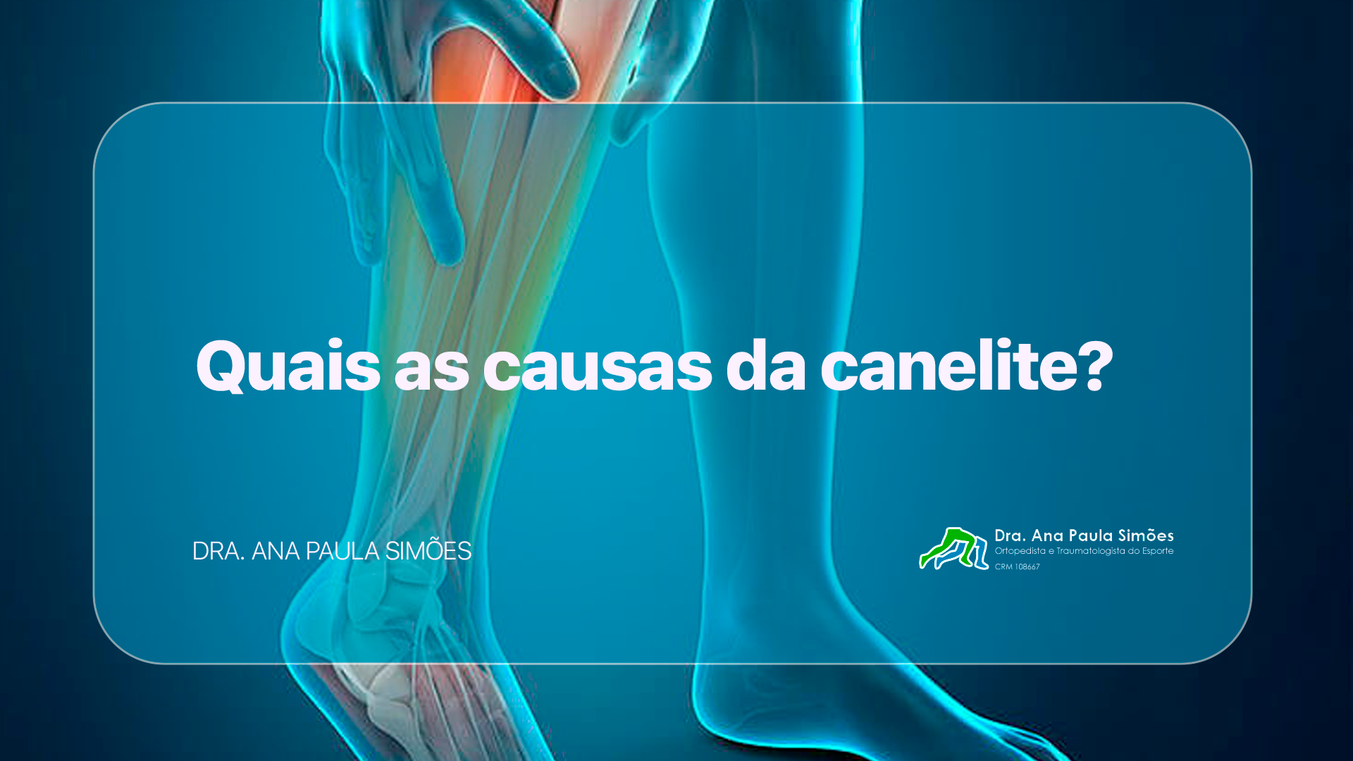 Quais as causas da canelite?