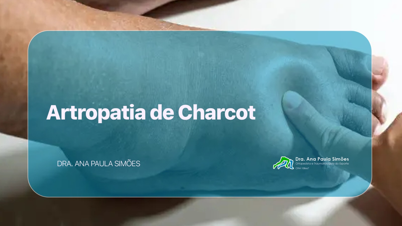 Artropatia de Charcot 