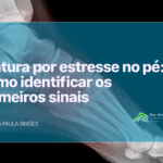 fratura por estresse
