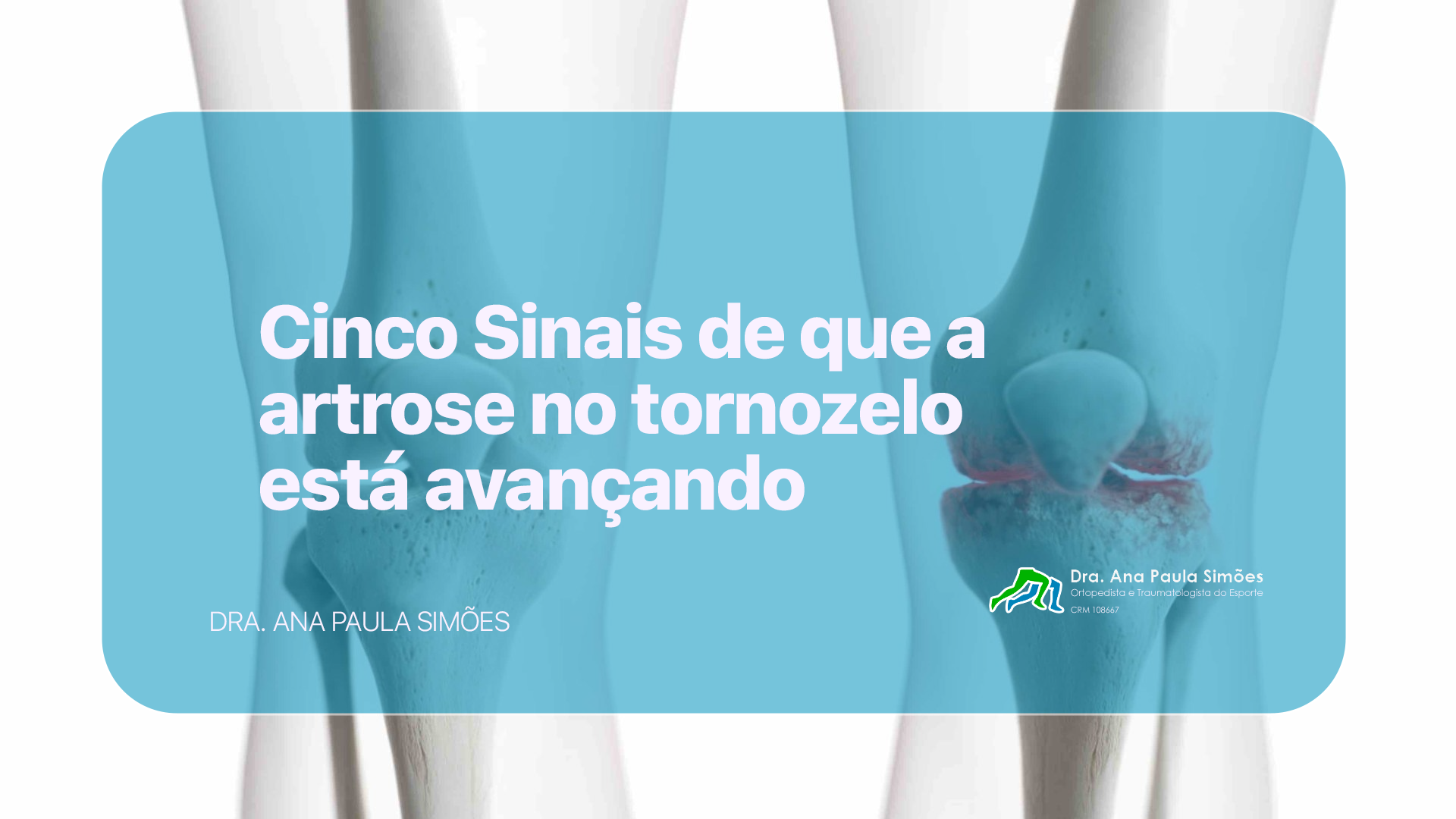 artrose no tornozelo