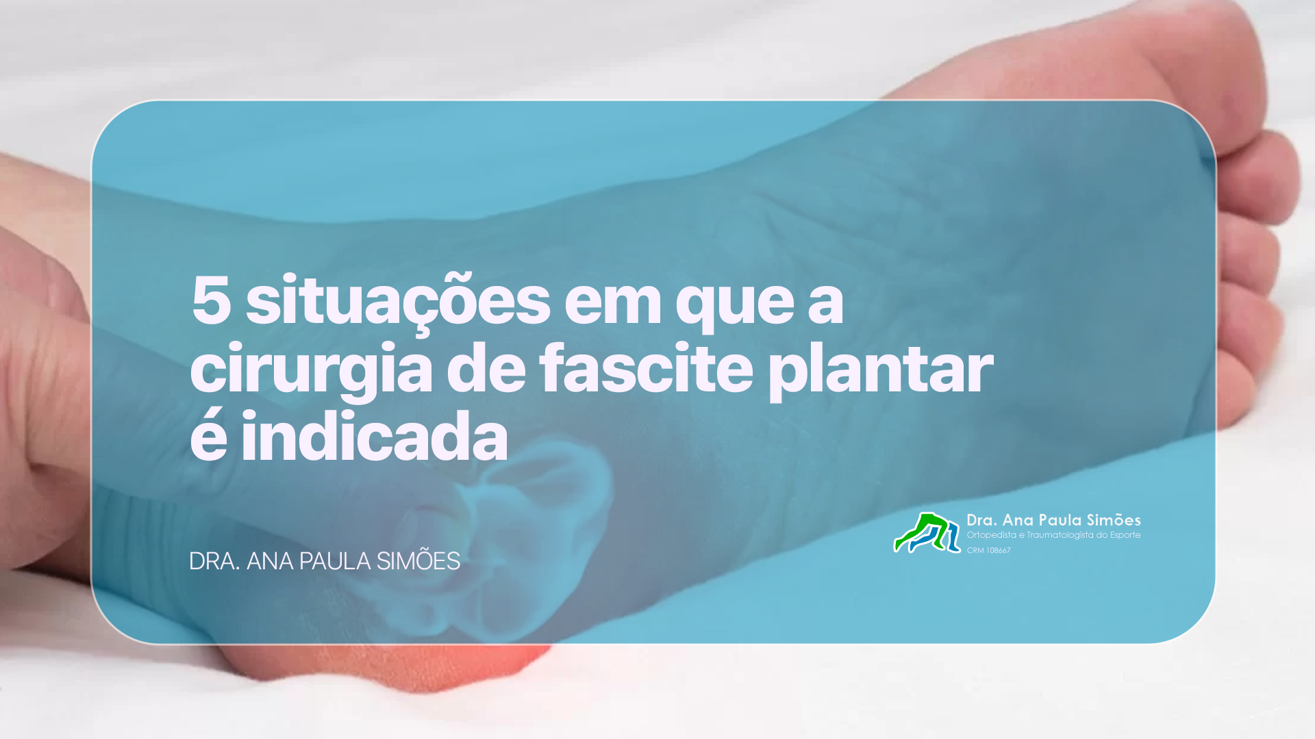 fascite plantar