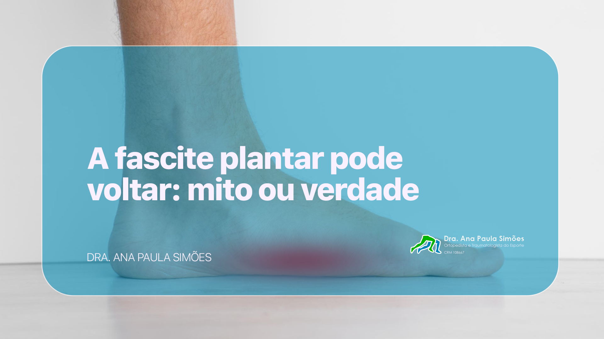 fascite plantar